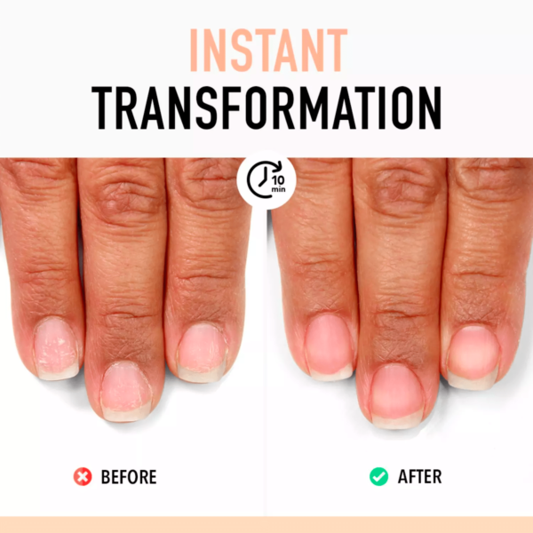 Nail Probiotic Instant Boost - Image 2